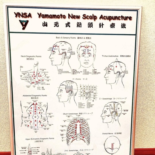 YNSA（山元式新頭鍼療法）について - 静岡駅南口より徒歩3分！静岡