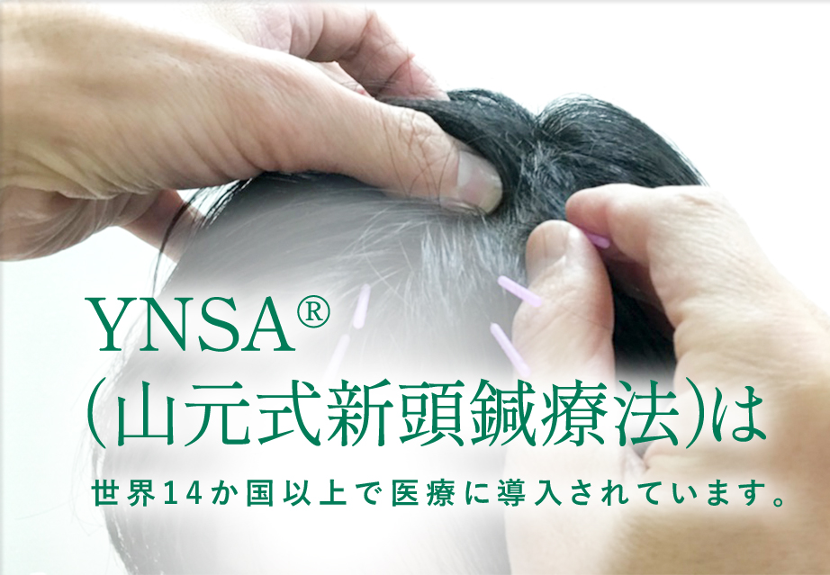 YNSA®（山元式新頭鍼療法）は世界14か国以上で医療に導入されています。